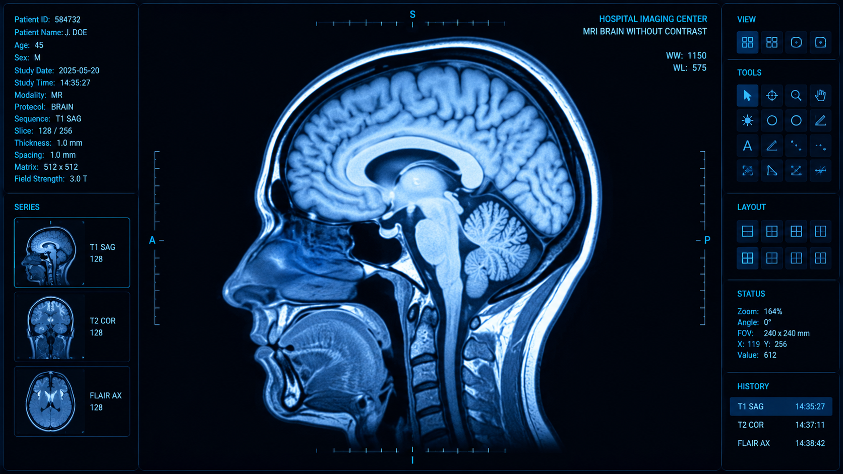 Does mold cause headaches? Brain scan evoking the neurological side of mold exposure